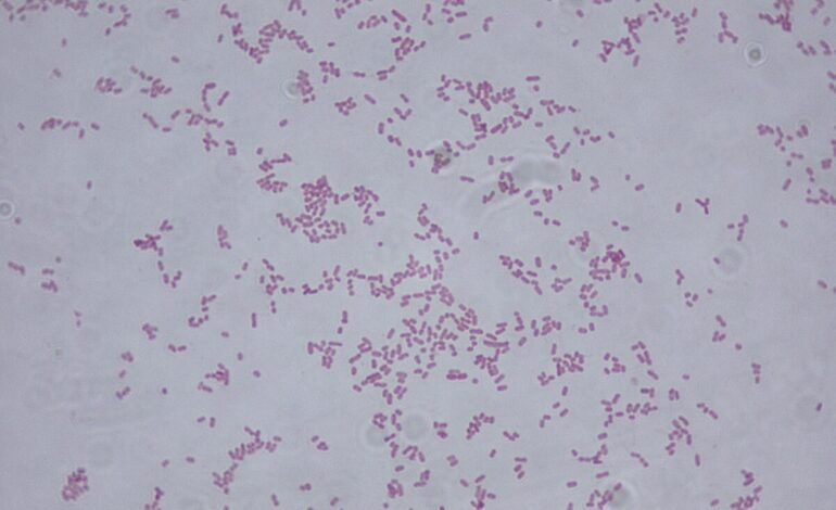 Alerta por bacteria en hospitales del Edomex