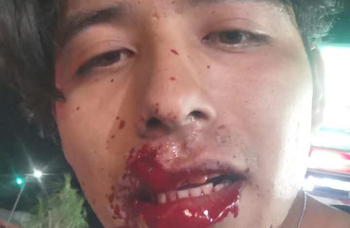 Agresor ataca a dos personas en Bugambilias; es detenido por la policía