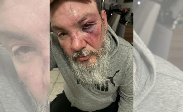 Detienen a uno de los agresores del periodista Fer Jara tras partido en el Cuauhtémoc