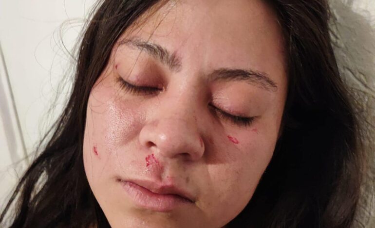 Policía en activo golpea y azota a su exnovia en la calle; temen que quede impune