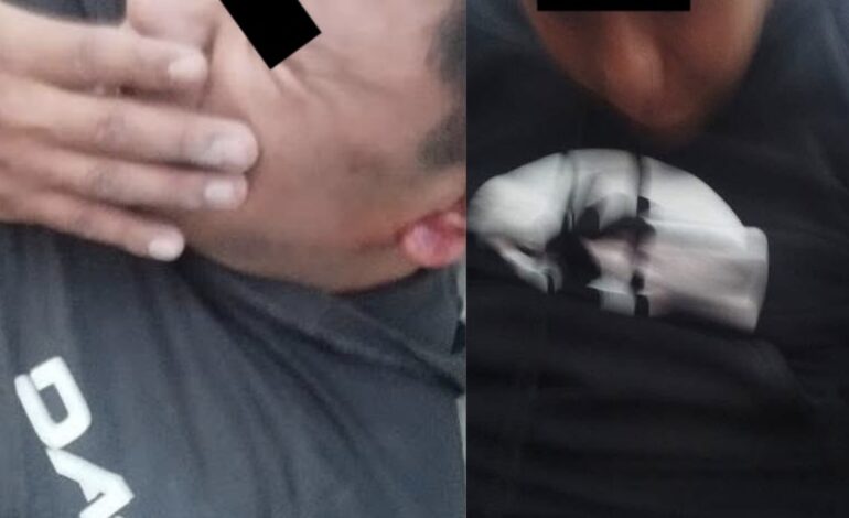 ¡Vecinos se hartan! Detienen y golpean a dos asaltantes en Agua Santa