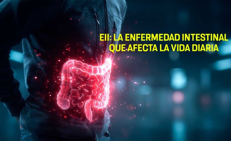 Enfermedad inflamatoria intestinal: una condición crónica que transforma la vida de millones de personas