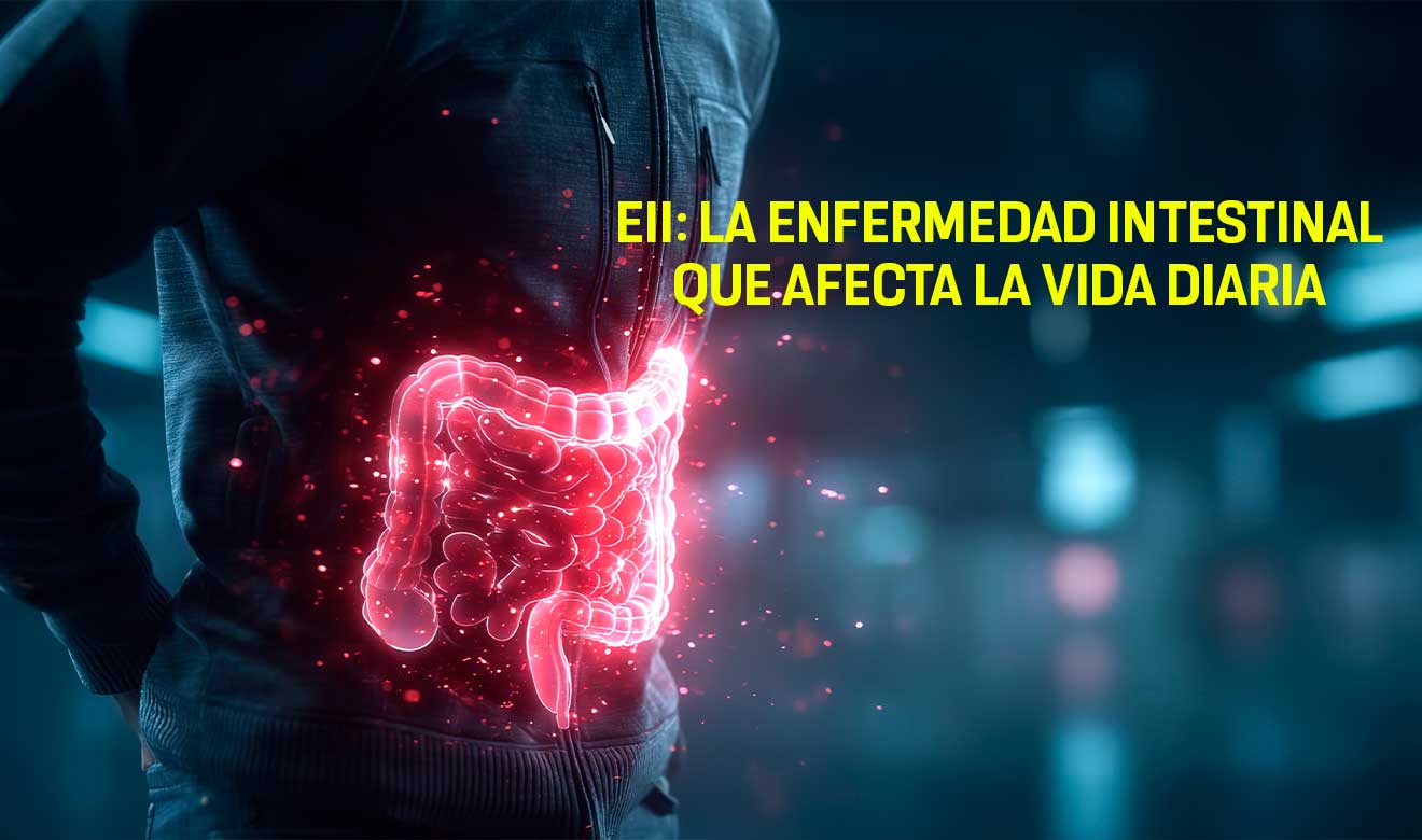 Enfermedad inflamatoria intestinal: una condición crónica que transforma la vida de millones de personas