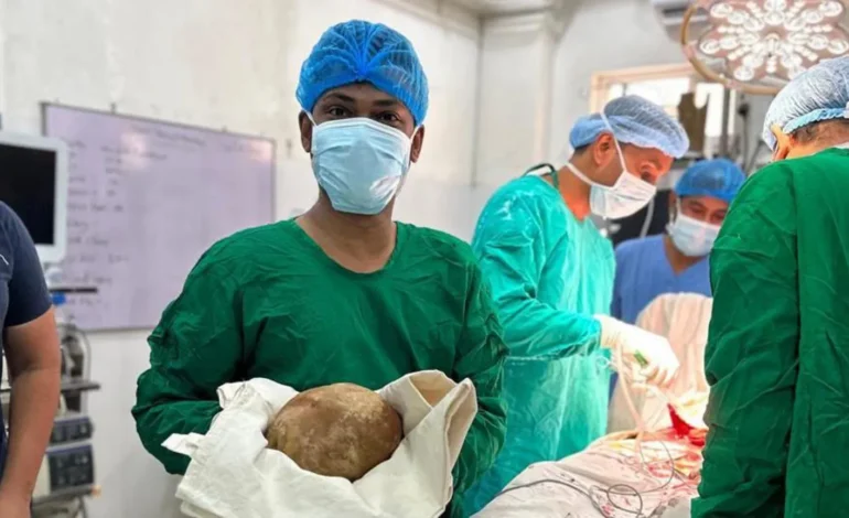 Médicos en Sri Lanka extraen una piedra de la vejiga de 3 kilos