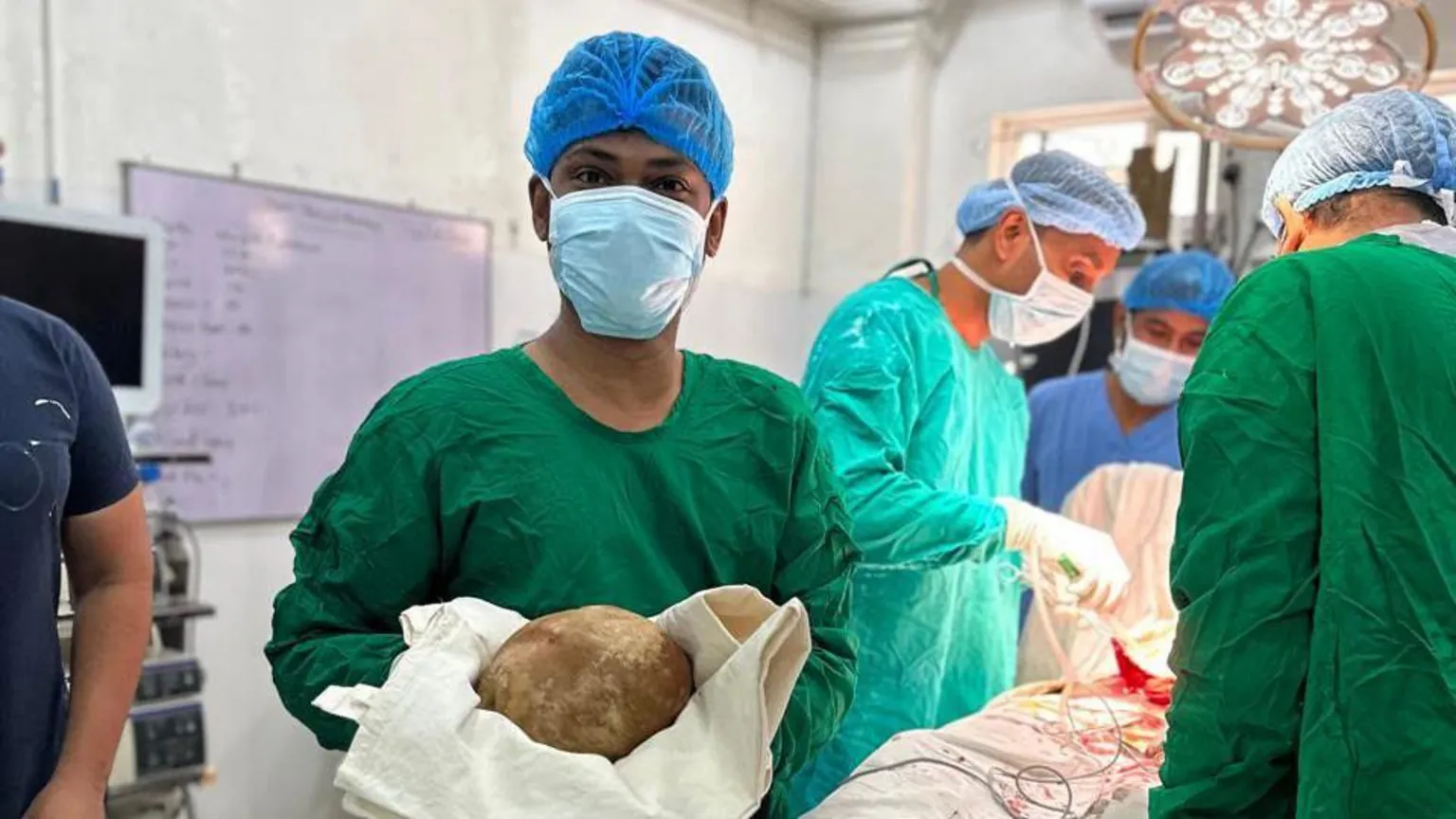 Médicos en Sri Lanka extraen una piedra de la vejiga de 3 kilos